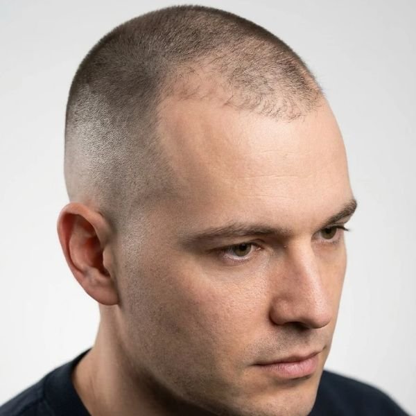 Does a fade help or hurt a bad hairline_